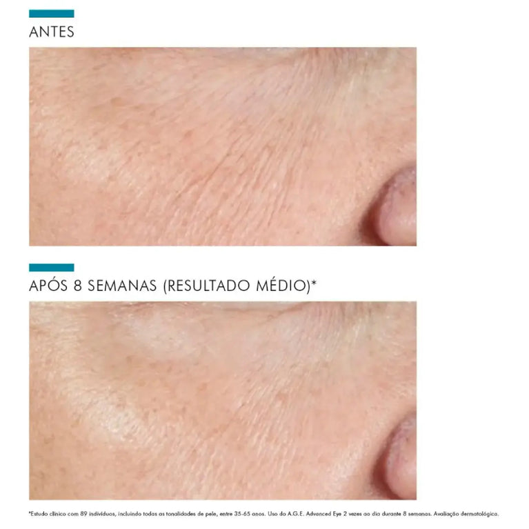 Creme Corretor para a Área dos Olhos Skinceuticals A.G.E. Advanced Eye 15ml
