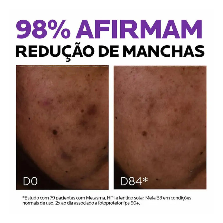 Sérum Antimanchas La Roche-Posay Mela B3 - 30ml
