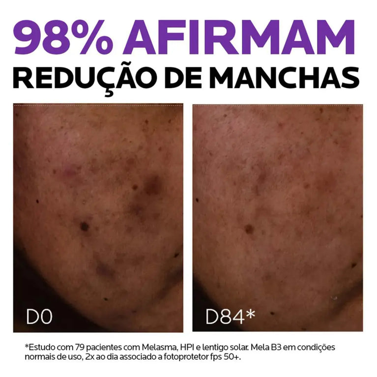 Sérum Antimanchas Facial La Roche-Posay Mela B3 Clareador Melasyl 10% e Niacinamida para Manchas 15ml