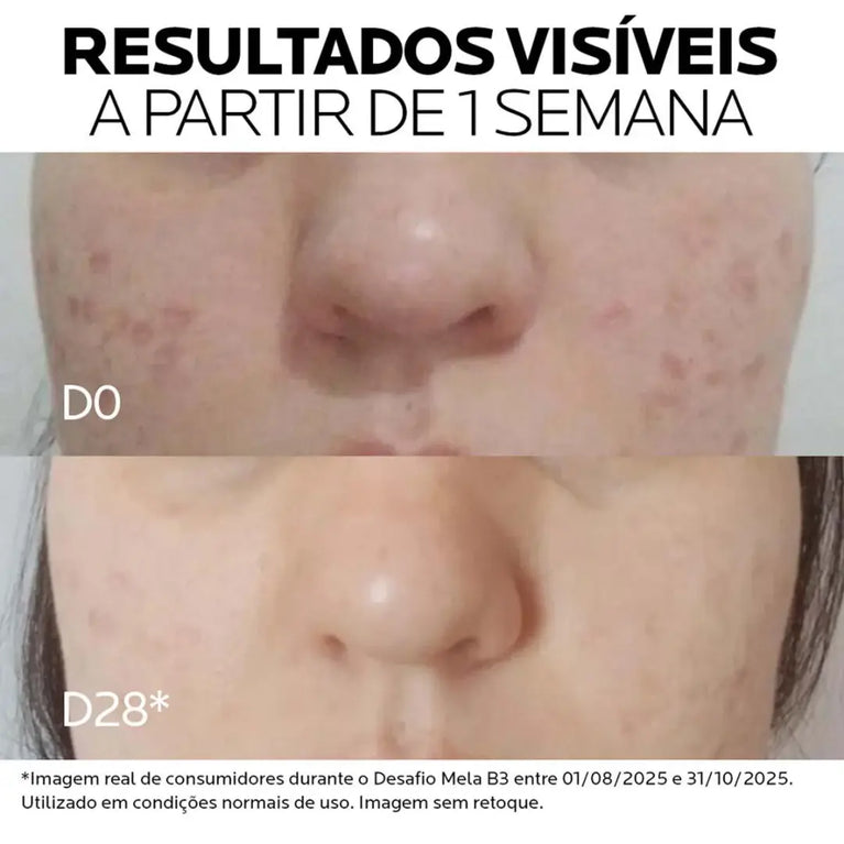 Sérum Antimanchas Facial La Roche-Posay Mela B3 Clareador Melasyl 10% e Niacinamida para Manchas 15ml