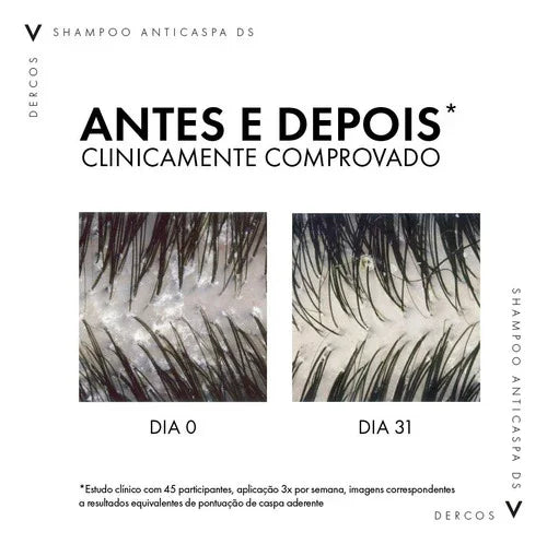 Shampoo Dercos Anti Caspa Ds Cabelos Normais A Oleosos 125g