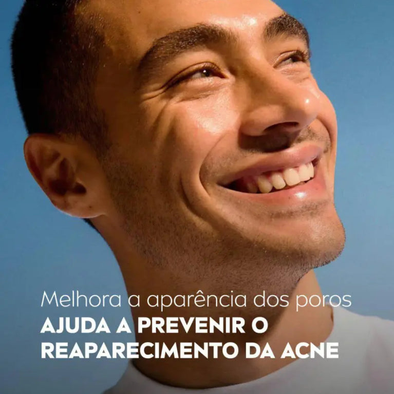 Sabonete Facial Nivea Acne Control Gel 150g