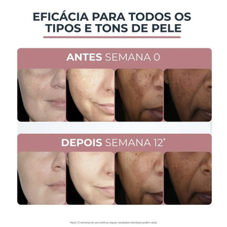 ANTI-PIGMENT DUAL SERUM FACIAL 30ML
