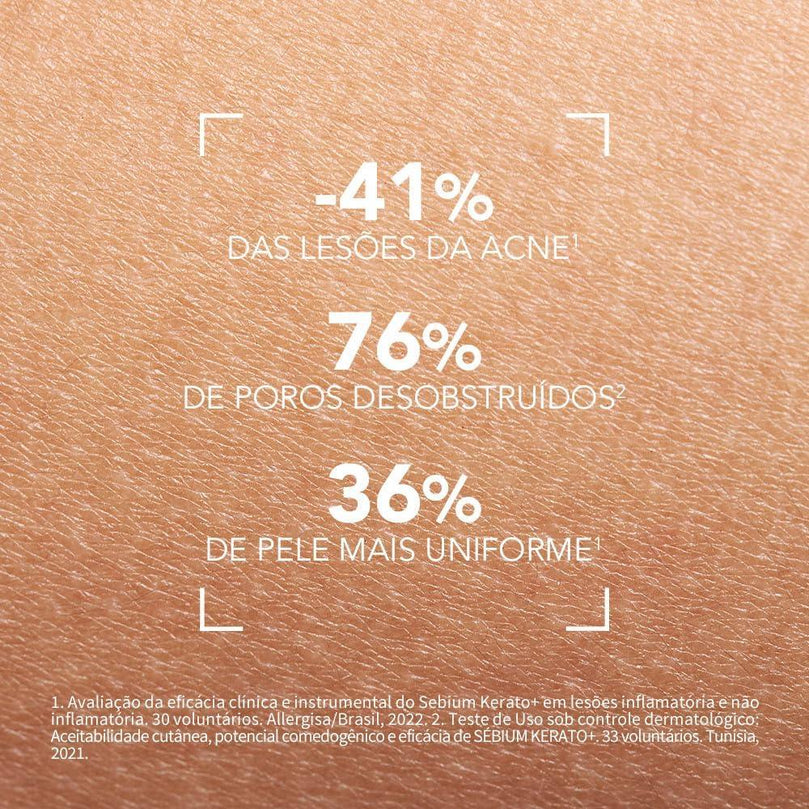 Gel Creme Antiacne Sebium Kerato+ 30ml Bioderma Momento De Aplicação Dia/noite Tipo De Pele Oleosa - Drogaria Poupa Centro
