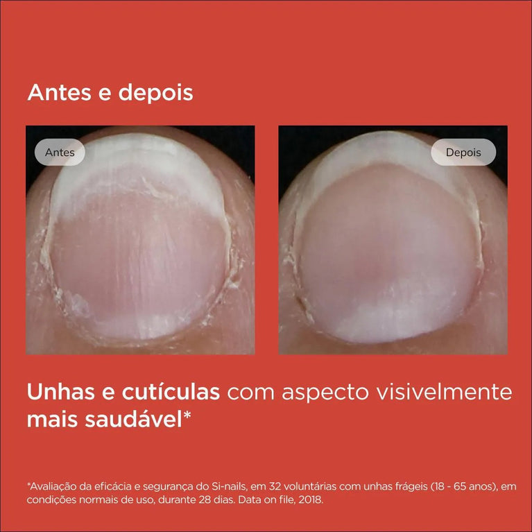 Fortalecedor de Unhas Isdin Si-Nails com 2,5ml